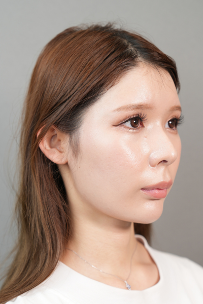 Postoperative Condition Part 1