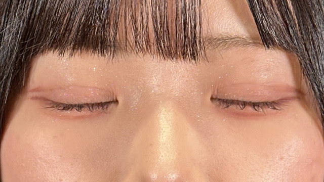 Postoperative Condition Part 1