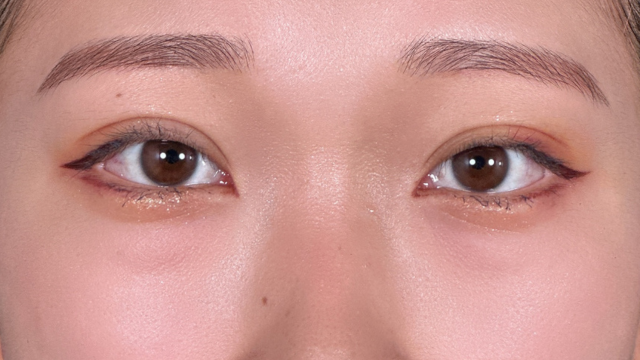 Postoperative Condition Part 1