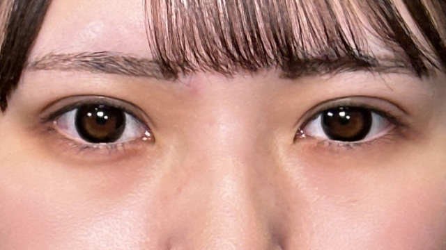 Postoperative Condition Part 1