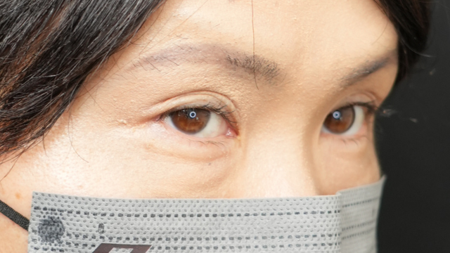 Postoperative Condition Part 1