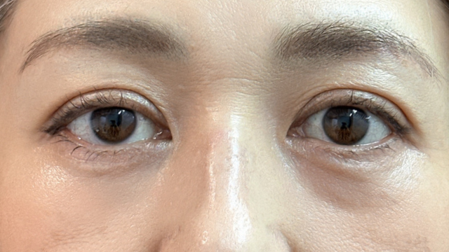 Postoperative Condition Part 1