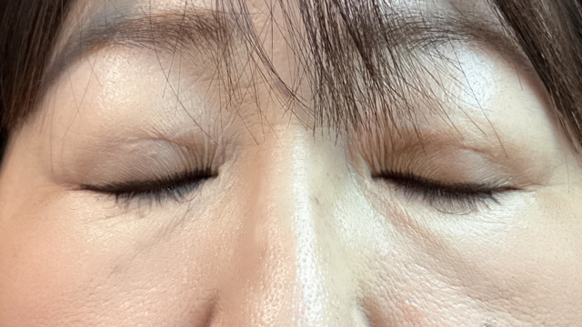 Postoperative Condition Part 1