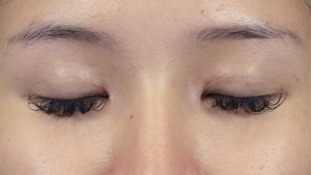 Postoperative Condition Part 1