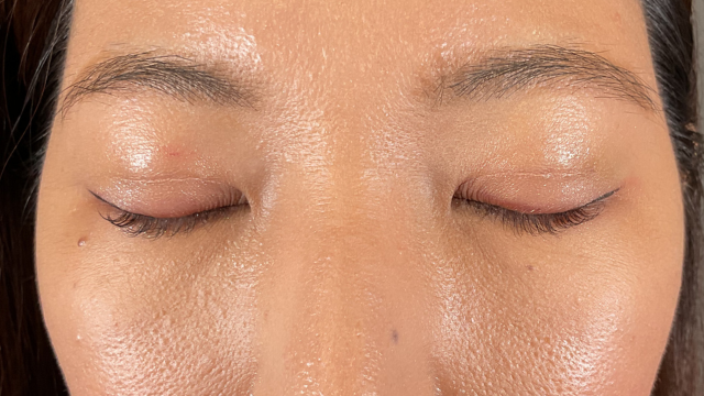 Postoperative Condition Part 1