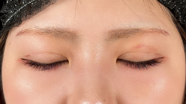 Postoperative Condition Part 1