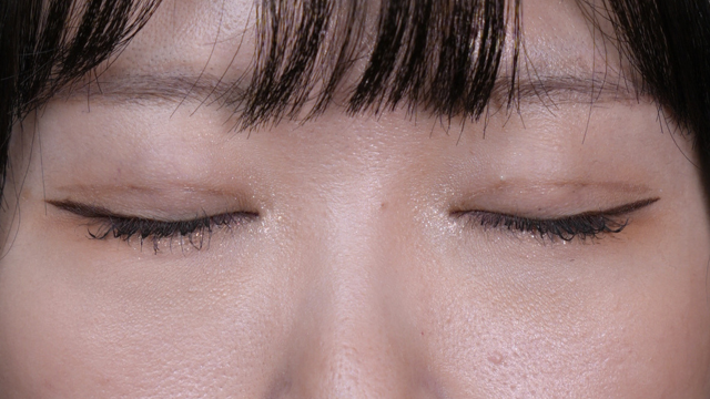 Postoperative Condition Part 1