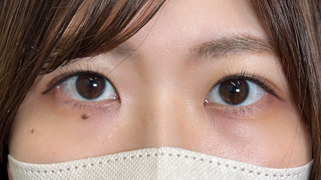 Postoperative Condition Part 1