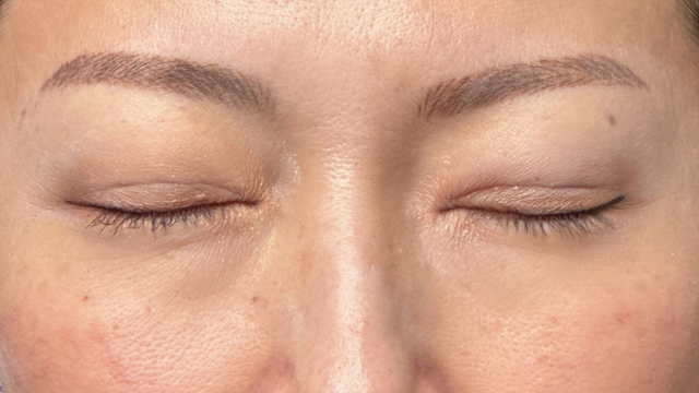 Postoperative Condition Part 1