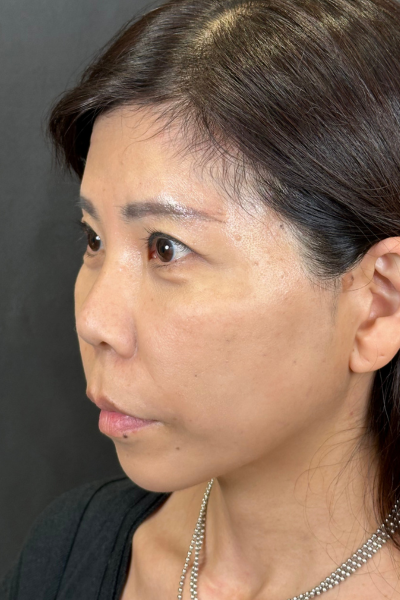 Postoperative Condition Part 1