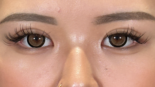 Postoperative Condition Part 1