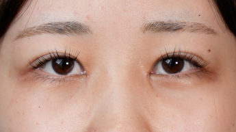 Postoperative Condition Part 1