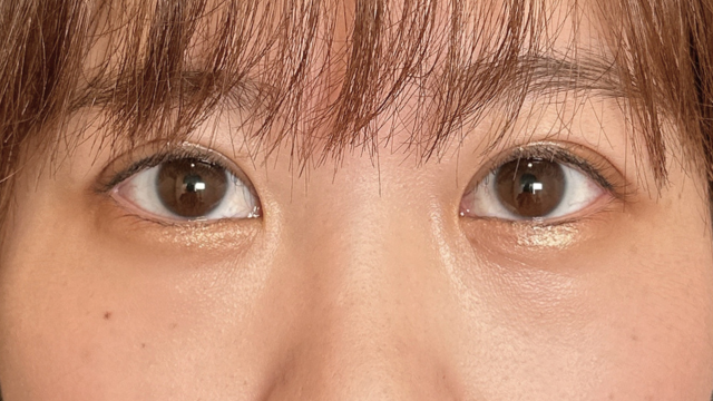 Postoperative Condition Part 1