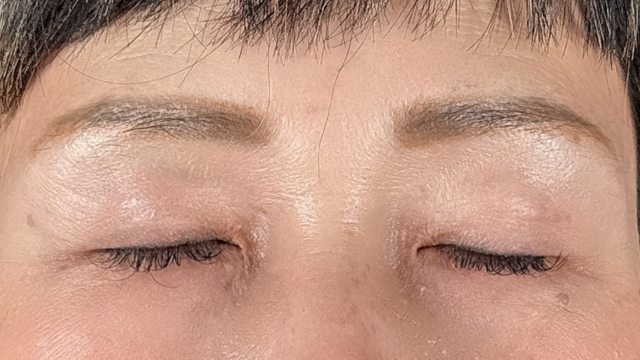 Postoperative Condition Part 1