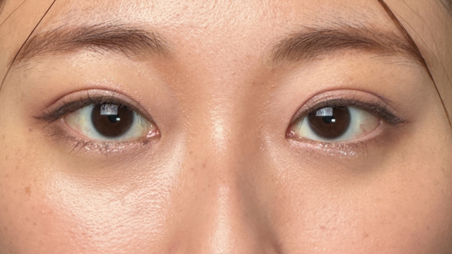 Postoperative Condition Part 1