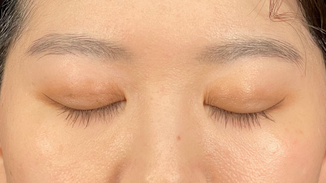 Postoperative Condition Part 1