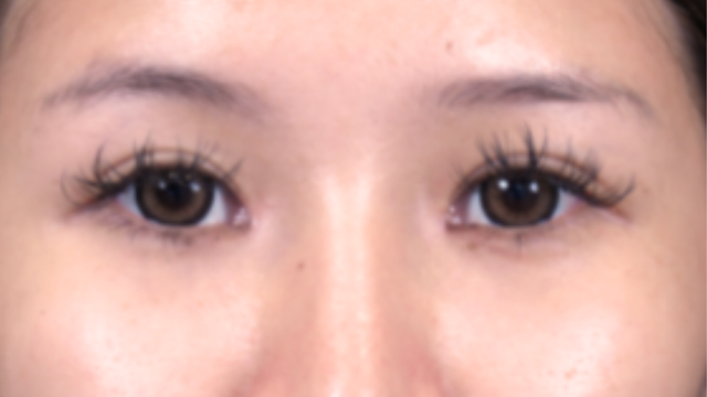 Postoperative Condition Part 1