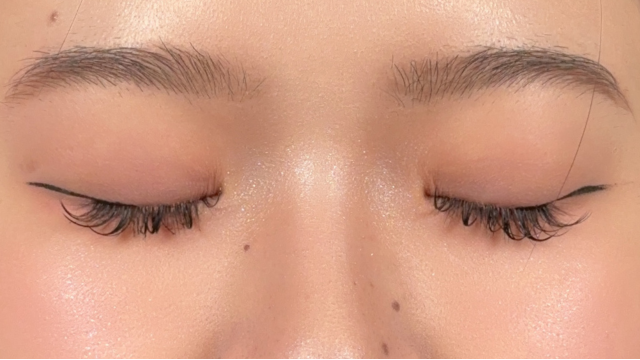 Postoperative Condition Part 1