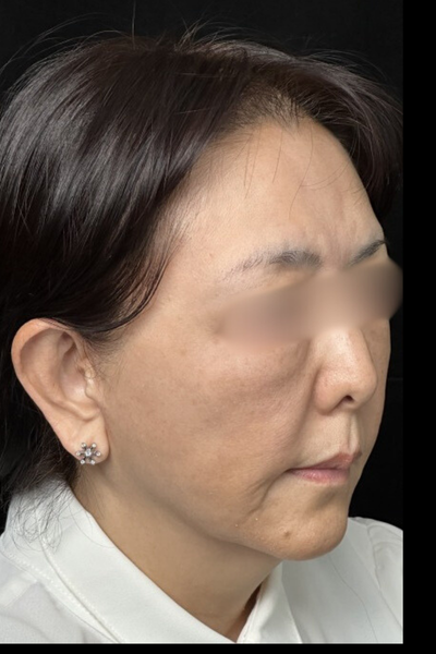 手術前の状態 その1