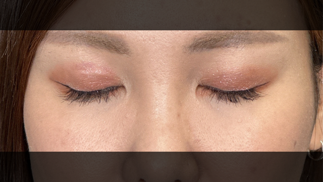 Postoperative Condition Part 1