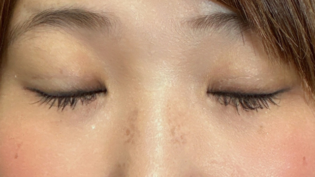 Postoperative Condition Part 1