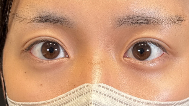 Postoperative Condition Part 1