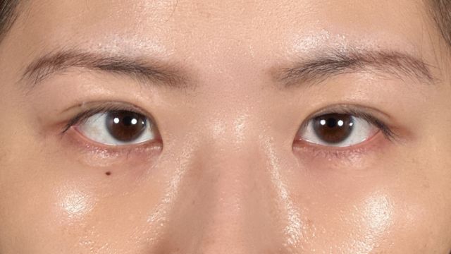 Postoperative Condition Part 1