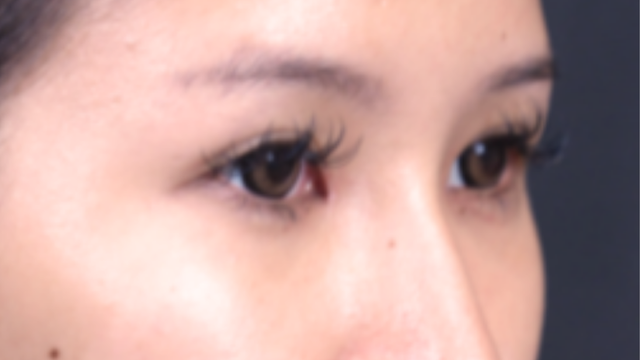 Postoperative Condition Part 1