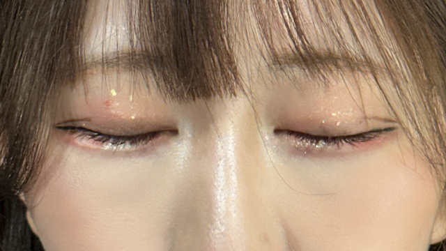 Postoperative Condition Part 1