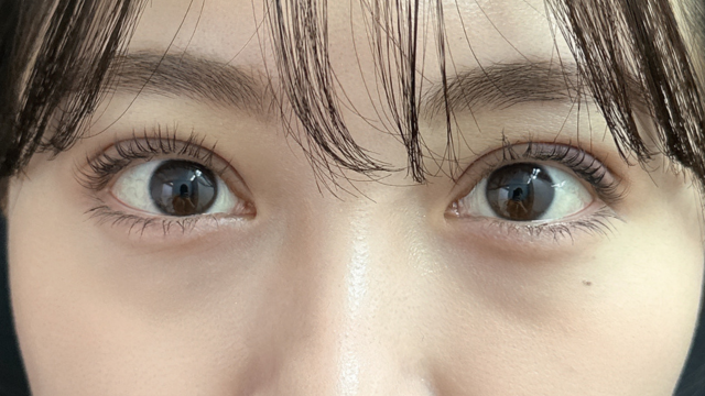 Postoperative Condition Part 1