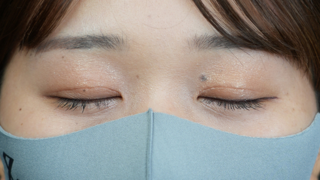 Postoperative Condition Part 1