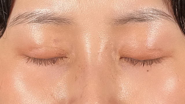 Postoperative Condition Part 1