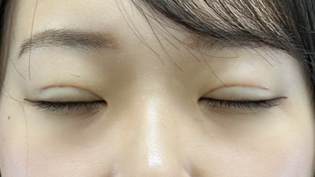 Postoperative Condition Part 1