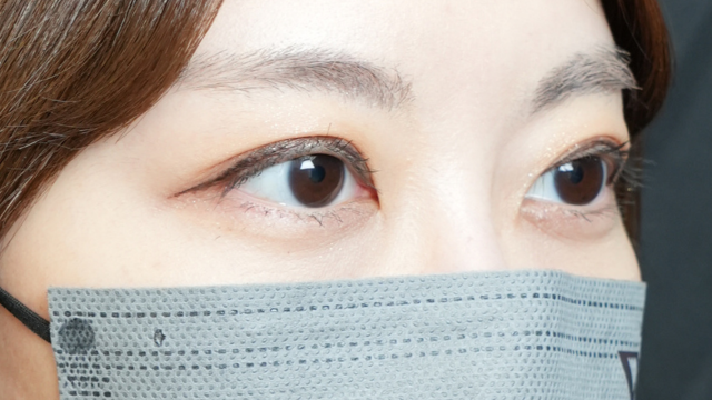 Postoperative Condition Part 1