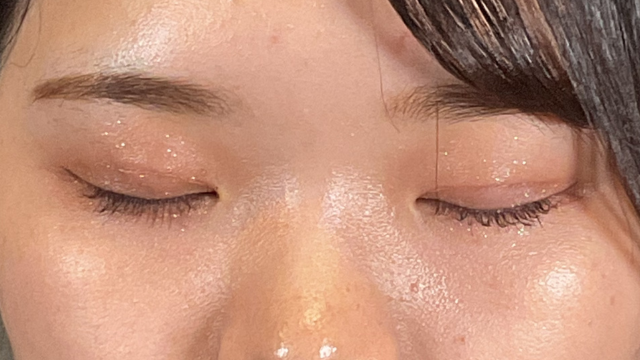 Postoperative Condition Part 1