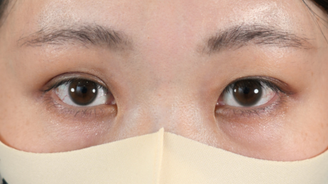 Postoperative Condition Part 1