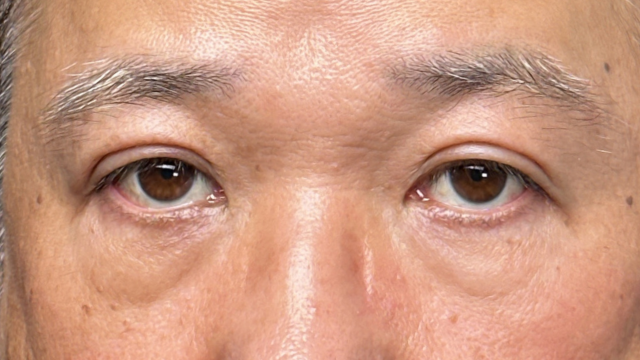 Postoperative Condition Part 1