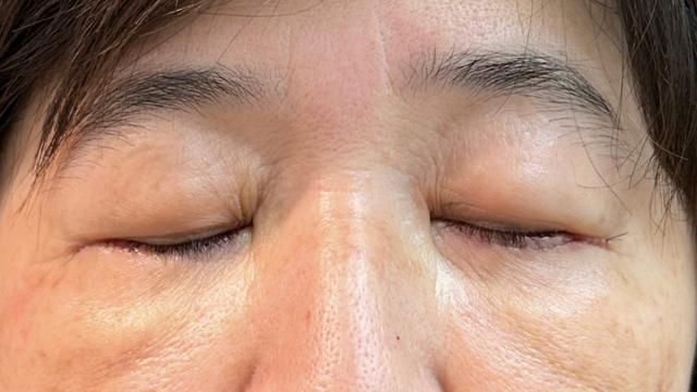 Postoperative Condition Part 1