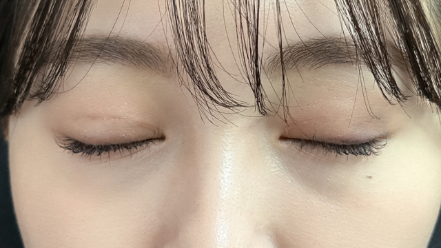 Postoperative Condition Part 1