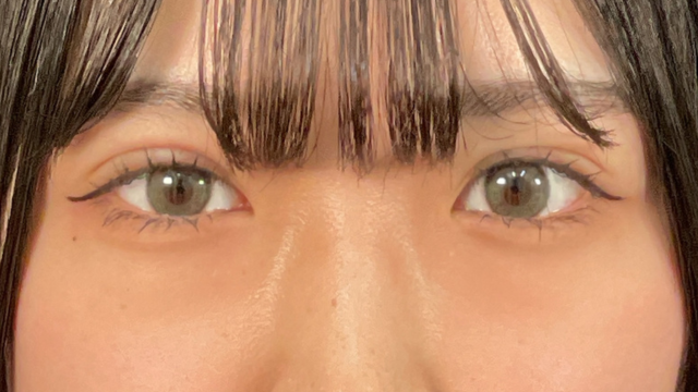 Postoperative Condition Part 1