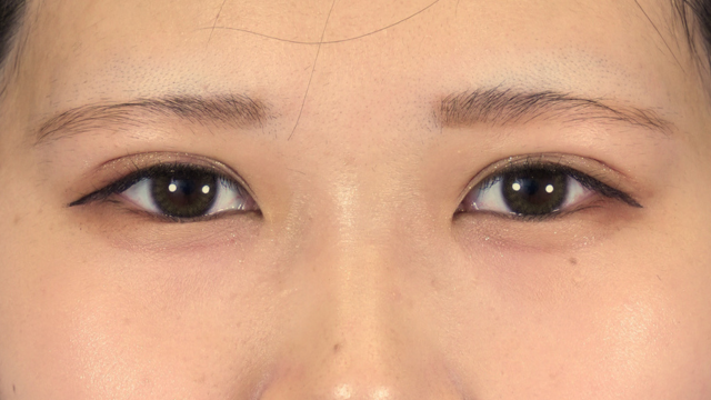 Postoperative Condition Part 1