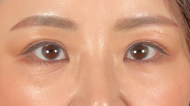 Postoperative Condition Part 1