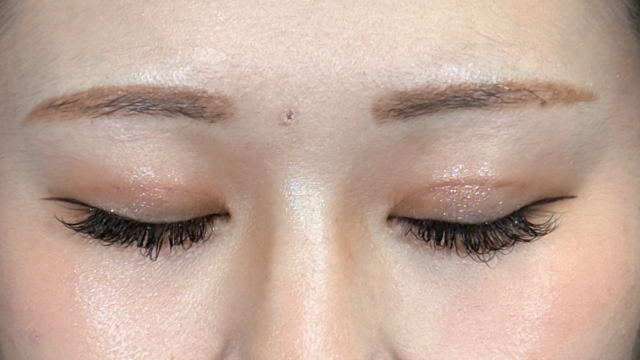 Postoperative Condition Part 1