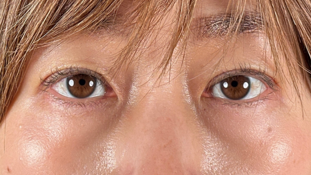 Postoperative Condition Part 1