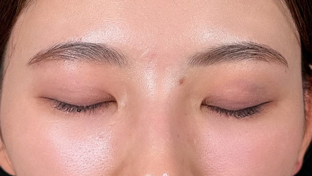 Postoperative Condition Part 1