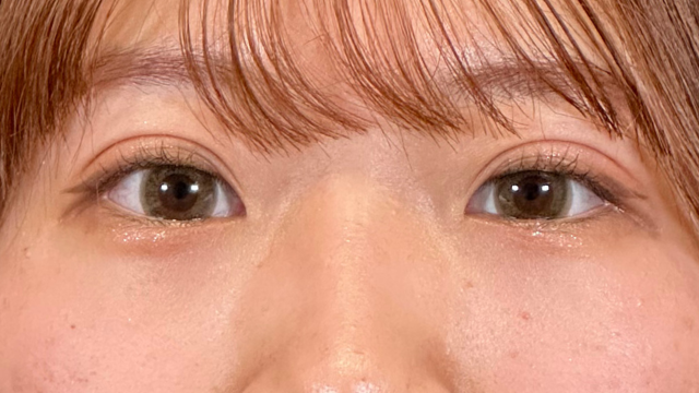 手术前的状态 其一