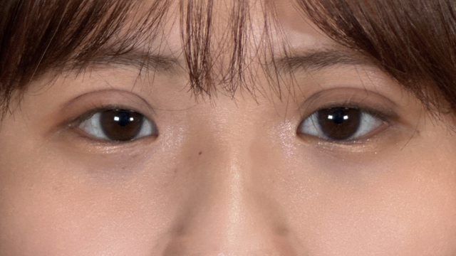 Postoperative Condition Part 1