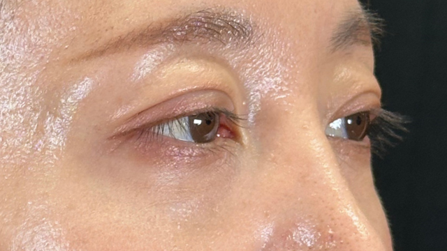 Postoperative Condition Part 1