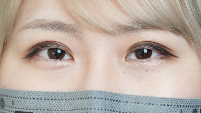 Postoperative Condition Part 1