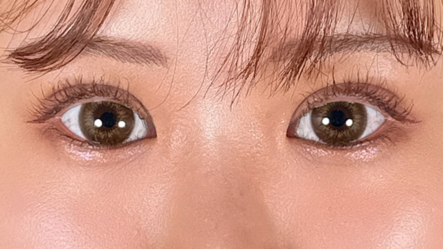 Postoperative Condition Part 1